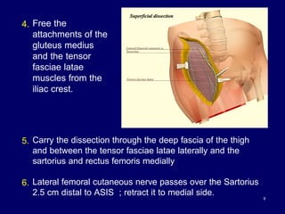 9
4. Free the
attachments of the
gluteus medius
and the tensor
fasciae latae
muscles from the
iliac crest.
5. Carry the dissection through the deep fascia of the thigh
and between the tensor fasciae latae laterally and the
sartorius and rectus femoris medially
6. Lateral femoral cutaneous nerve passes over the Sartorius
2.5 cm distal to ASIS ; retract it to medial side.
 