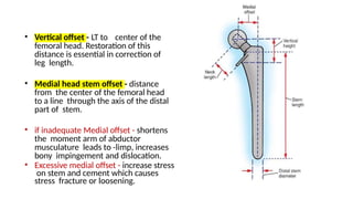 Left Helical Offset Hip joint anatomy and biomechanics of hip joint | PPTX