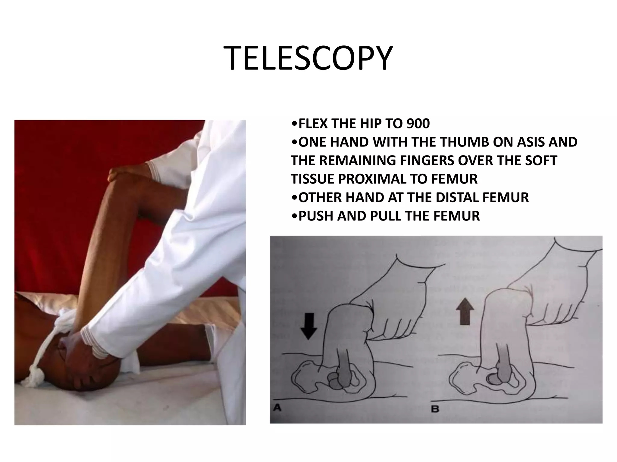 Hip clinical examination By Dr YAGNIK BHUVA | PPT