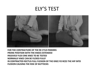 Eli Test Hip clinical examination By Dr YAGNIK BHUVA | PPTX