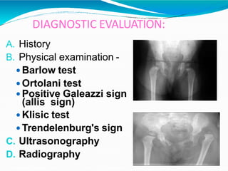 HIP DILOCATION.pptx