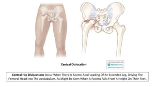 Adult Orthopedic Imaging Series: Presentation #2 Native Hip ...