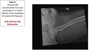 Adult Orthopedic Imaging Series: Presentation #2 Native Hip ...