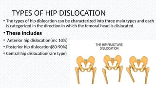 HIP DISLOCATION , MECHANISM AND MANAGEMENT.pptx
