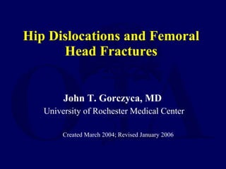 Hip Dislocations and Femoral Head Fractures ,[object Object],[object Object],[object Object]