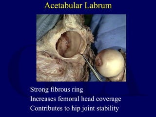 Acetabular Labrum <ul><li>Strong fibrous ring </li></ul><ul><li>Increases femoral head coverage </li></ul><ul><li>Contribu...