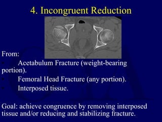 4. Incongruent Reduction <ul><li>From: </li></ul><ul><li>Acetabulum Fracture (weight-bearing  portion). </li></ul><ul><li>...