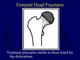 Femoral Head Fractures <ul><li>Treatment principles similar to those listed for hip dislocations. </li></ul>