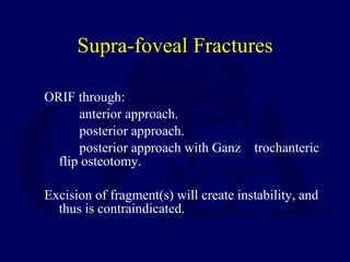 Supra-foveal Fractures <ul><li>ORIF through: </li></ul><ul><li>anterior approach. </li></ul><ul><li>posterior approach. </...