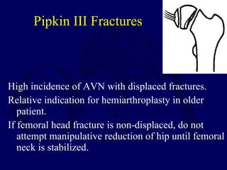Pipkin III Fractures <ul><li>High incidence of AVN with displaced fractures. </li></ul><ul><li>Relative indication for hem...