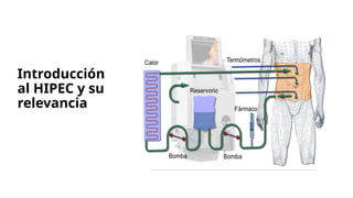 HIPEC en cáncer de ovario.pptx ESTUDIO OVHIPEC | PPTX