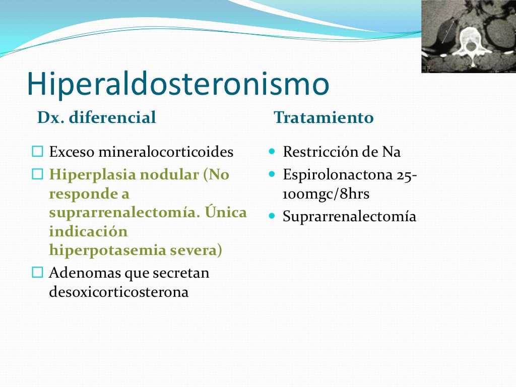Hiperaldosteronismo