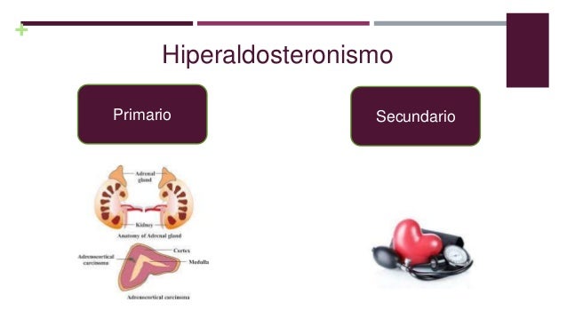 Hiperaldosteronismo