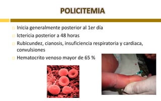 La bilirrubina conjugada entra al TGI , una parte es transformada en urobilinogeno por accion de las bacterias y eliminada a través de heces.