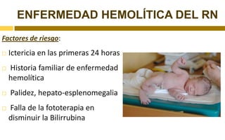 Por medio de la enzima beta glucoronidasa puede ser convertida nuevamente a bilirrubina no conjugada y regresada nuevamente al hígado -> CIRCULACION ENTEROHEPATICA.MANIFESTACION CLINICALa ictericia,que tiene una aparición progresiva céfalo-caudal existiendo una relación entre el  segmento afectado y el  nivel de bilirrubina: