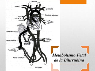 Hiperbilirrubinemia neonatal | PPTX