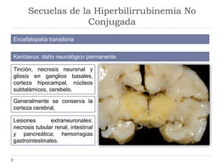 Secuelas de la Hiperbilirrubinemia No
Conjugada
Encefalopatía transitoria
Kericterus: daño neurológico permanente
Tinción,...