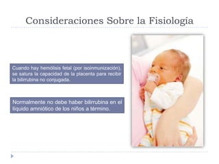 Consideraciones Sobre la Fisiología
Cuando hay hemólisis fetal (por isoinmunización),
se satura la capacidad de la placent...