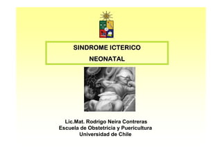 SINDROME ICTERICO
           NEONATAL




  Lic.Mat. Rodrigo Neira Contreras
Escuela de Obstetricia y Puericultura
       Universidad de Chile
 