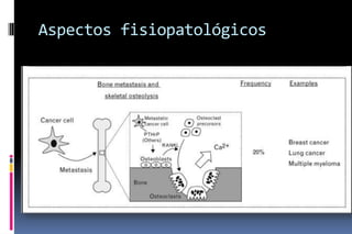Aspectos fisiopatológicos
 