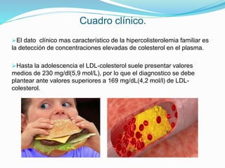 Cuadro clínico.
El dato clínico mas característico de la hipercolisterolemia familiar es
la detección de concentraciones elevadas de colesterol en el plasma.
Hasta la adolescencia el LDL-colesterol suele presentar valores
medios de 230 mg/dl(5,9 mol/L), por lo que el diagnostico se debe
plantear ante valores superiores a 169 mg/dL(4,2 mol/l) de LDL-
colesterol.
 
