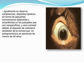 Igualmente se observa
xantelasmas, depósitos lipidicos
en forma de pequeñas
tumoraciones aplanadas y
amarillentas en los parpados que
son inespecíficos, y arco corneal
debido al deposito de colesterol
alrededor de la cornea que es
patognomónico en personas de
menos de 45 años.
 