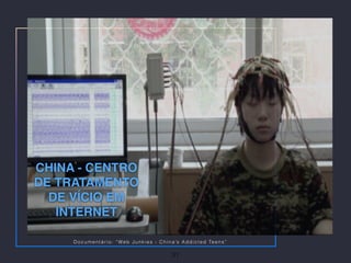 CHINA - CENTRO
DE TRATAMENTO
DE VÍCIO EM
INTERNET
31
Documentário: “Web Junkies - China’s Addicted Teens”
 