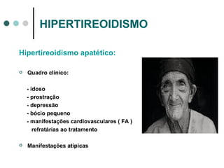 HIPERTIREOIDISMO Hipertireoidismo apatético: Quadro clínico: - idoso - prostração - depressão - bócio pequeno - manifestações cardiovasculares ( FA ) refratárias ao tratamento  Manifestações atípicas 