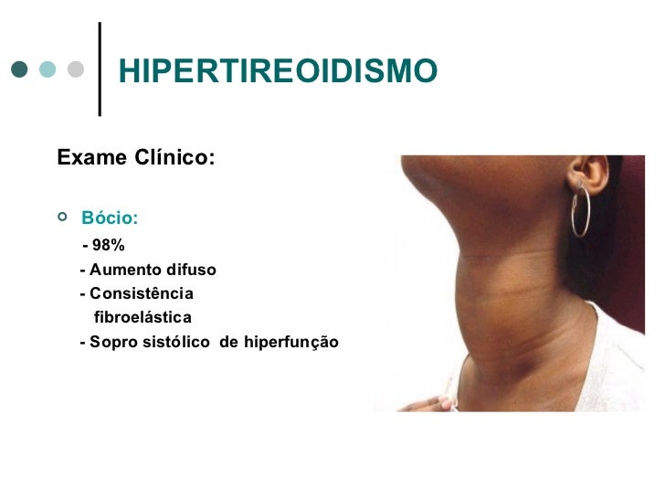 Exame hipotireoidismo