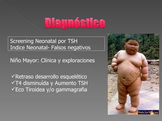 Screening Neonatal por TSH
Indice Neonatal- Falsos negativos

Niño Mayor: Clínica y exploraciones

Retraso desarrollo esquelético
T4 disminuída y Aumento TSH
Eco Tiroidea y/o gammagrafia



                                      34
 