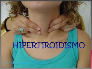 http://escuela.med.puc.cl/publ/boletin/tiroidea/TrastornosTiroideosNino.html
 