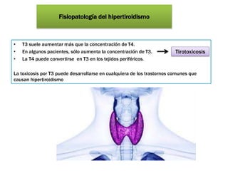 Fisiopatología del hipertiroidismo
• T3 suele aumentar más que la concentración de T4.
• En algunos pacientes, sólo aumenta la concentración de T3.
• La T4 puede convertirse en T3 en los tejidos periféricos.
La toxicosis por T3 puede desarrollarse en cualquiera de los trastornos comunes que
causan hipertiroidismo
Tirotoxicosis
 