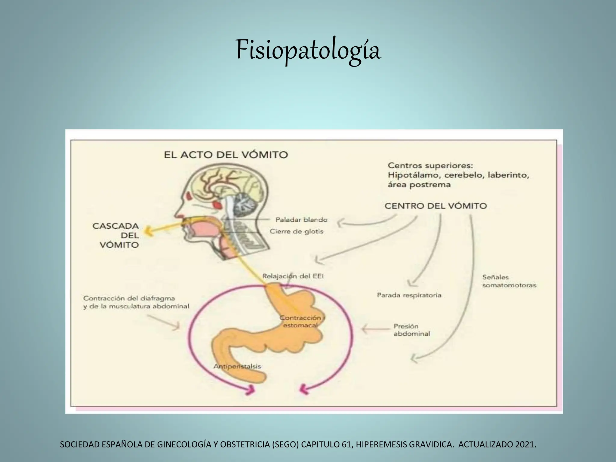 hiper emesis gravidica Tania maestre.pptx