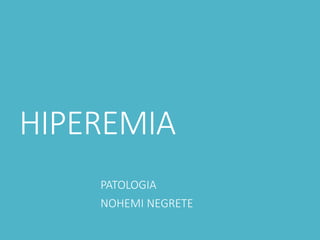 HIPEREMIA
PATOLOGIA
NOHEMI NEGRETE
 