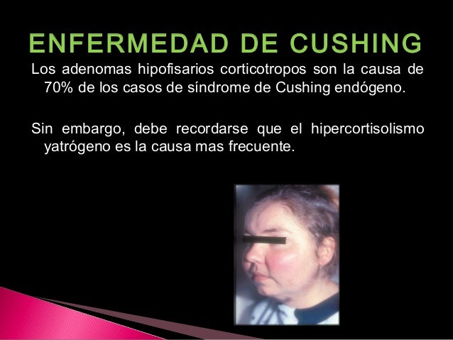 Hiperfuncion hipofuncion hipofisis