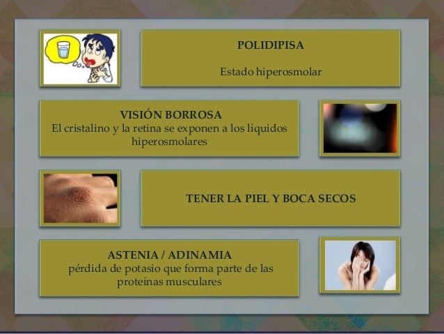 Hiperglucemia Hiperglucemia