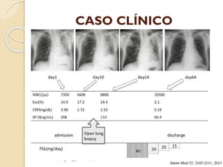 CASO CLÍNICO

 