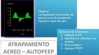 HIPERINFLACION DINAMICA.pptx