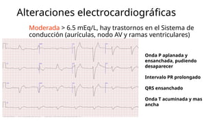 desequilibrio hidroelectrolitico Hiperkalemia e hipokalemia .pptx