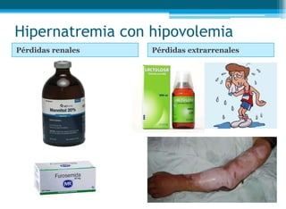 Hipernatremia con hipovolemia
Pérdidas renales Pérdidas extrarrenales
 