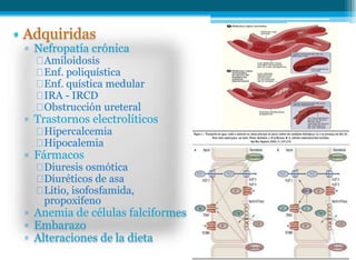 • Adquiridas
▫ Nefropatía crónica
Amiloidosis
Enf. poliquística
Enf. quística medular
IRA - IRCD
Obstrucción ureteral
▫ Trastornos electrolíticos
Hipercalcemia
Hipocalemia
▫ Fármacos
Diuresis osmótica
Diuréticos de asa
Litio, isofosfamida,
propoxifeno
▫ Anemia de células falciformes
▫ Embarazo
▫ Alteraciones de la dieta
 