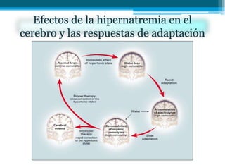 Efectos de la hipernatremia en el
cerebro y las respuestas de adaptación
 