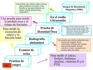 Pruebas de sangre Examen de orina Prueba de Densidad Ósea En el cuello Ultrasonido Radiografía abdominal Para medir el calcio, fósforo, fosfatasa alcalina, vitamina D y/o PTH  Para medir la excreción de calcio y la función renal Una prueba que utiliza radiación para tomar una imagen de las estructuras internas del cuerpo; esta prueba puede mostrar  cálculos renales  causados por niveles altos de calcio  Una prueba para medir la pérdida ósea y el riesgo de fracturas  Una prueba que utiliza ondas sonoras para examinar el cuerpo. Esta prueba se usa para detectar un tumor grande paratiroideo (adenoma)  Imagen de Resonancia Magnética (MRI) o Escáner Tecnecio 99m Sestamibi - un MRI es una prueba que utiliza ondas magnéticas para tomar imágenes de estructuras internas del cuerpo. Estos escáneres se usan para localizar un solo adenoma paratiroideo.  HC 