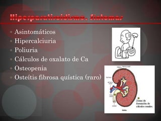  Asintomáticos
 Hipercalciuria
 Poliuria
 Cálculos de oxalato de Ca
 Osteopenia
 Osteítis fibrosa quística (raro)
 