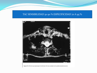 TAC SENSIBILIDAD 50 90 % ESPECIFICIDAD 70 A 95 %
 