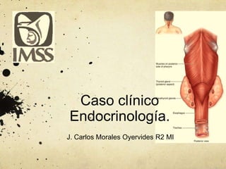 Caso clínico
Endocrinología.
J. Carlos Morales Oyervides R2 MI

 