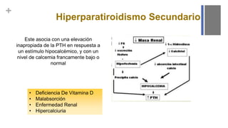 +
Hiperparatiroidismo Secundario
Este asocia con una elevación
inapropiada de la PTH en respuesta a
un estímulo hipocalcémico, y con un
nivel de calcemia francamente bajo o
normal
• Deficiencia De Vitamina D
• Malabsorción
• Enfermedad Renal
• Hipercalciuria
 