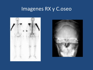 Imagenes RX y C.oseo 