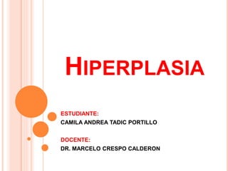 HIPERPLASIA
ESTUDIANTE:
CAMILA ANDREA TADIC PORTILLO
DOCENTE:
DR. MARCELO CRESPO CALDERON
 