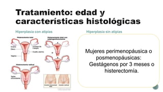Hiperplasia con atipias Hiperplasia sin atipias
Mujeres en edad fértil y
con deseos de
descendencia:
inducir ovulación
Mujeres en edad fértil sin deseos de gestación:
• Gestágenos en la segunda fase del ciclo
• DIU de levonogestrel
• Tratamiento combinado de estrógenos-
gestágenos
• Danazol
• Análogos GnRH
• Aquellas mujeres que rechacen el tratamiento
médico o en las que persista la hiperplasia, se
les ofertará histerectomía.
Mujeres perimenopáusica o
posmenopáusicas:
Gestágenos por 3 meses o
histerectomía.
 